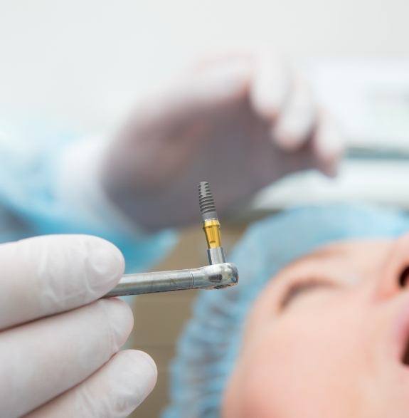 Dentist holding a dental implant right before placing it in a patient